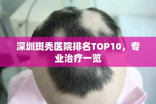 深圳斑秃医院排名TOP10,专业治疗一览